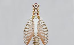 Ankylosing Spondylitis