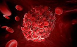 Hemophilia