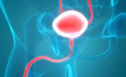 Urothelial Cancer